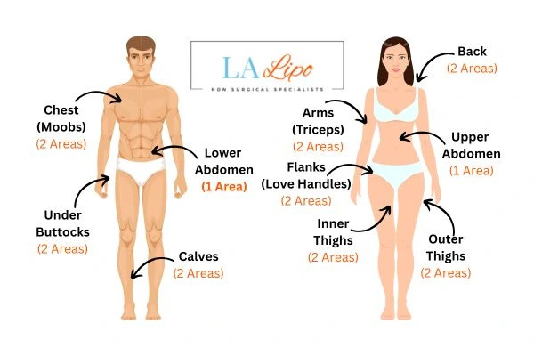 LA LIPO Cryolipolysis Areas Somerset
