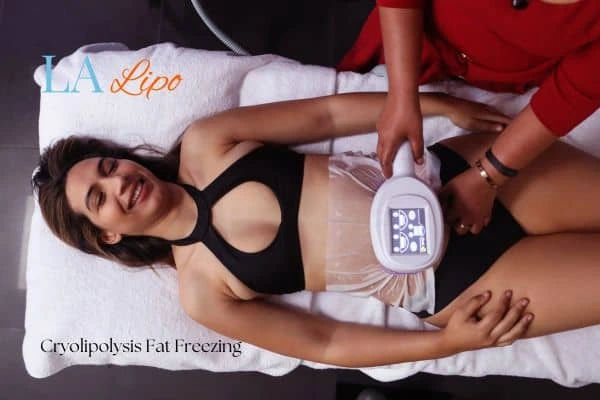 woman getting cryolipolysis Somerset