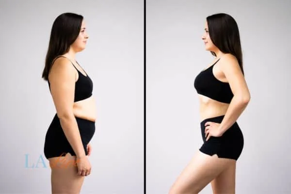 link between body image and mental health Somerset